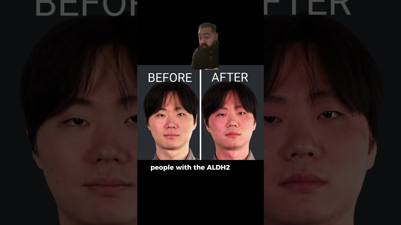 Doctor Explains Why Asians Go Red After Drinking!