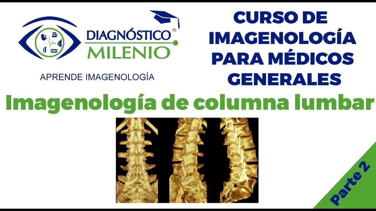 Imagenología de columna lumbar  Parte 2