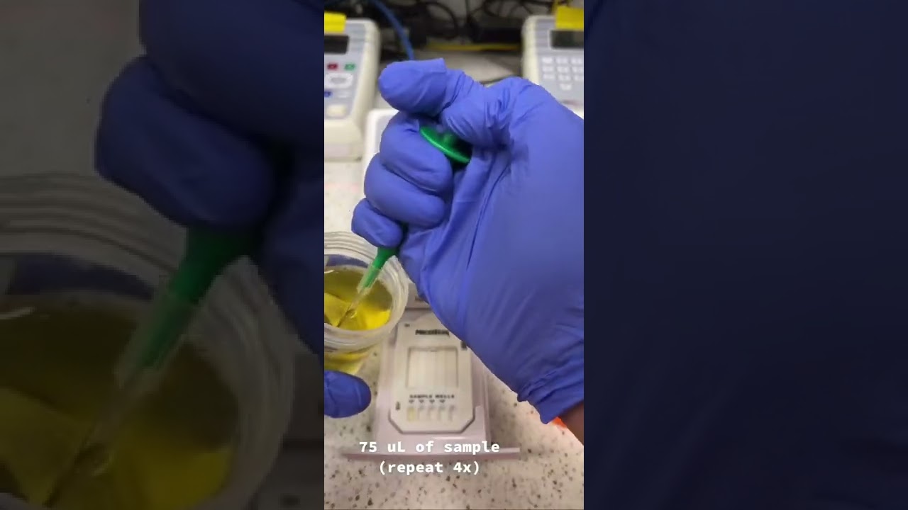 Urine Drug Screen: How it&rsquo;s Done 🧪