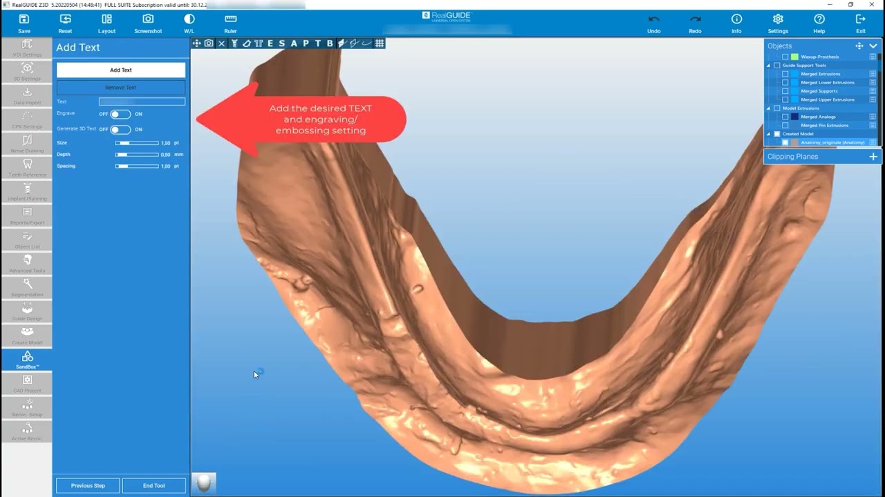 RealGUIDE Software: Model From Scan