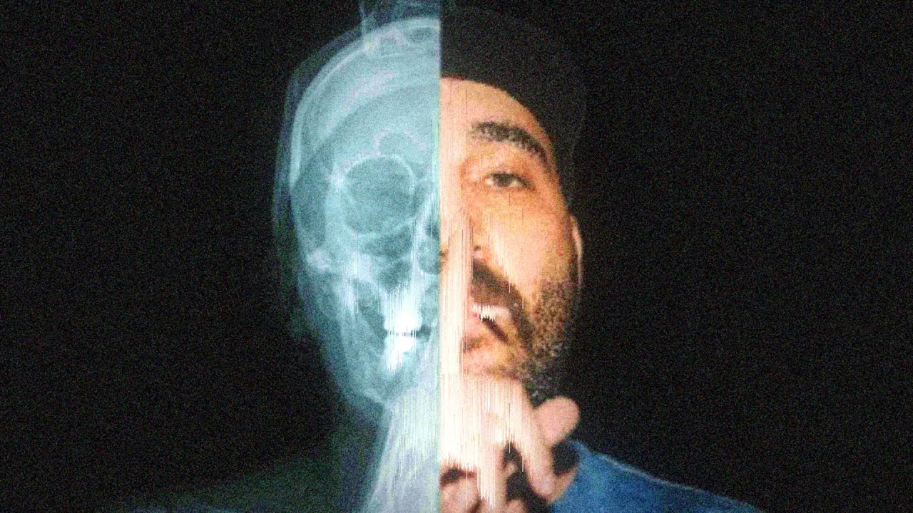 Never see me again - Done Done Streamw. Btachoo & Kiana Vitiligo