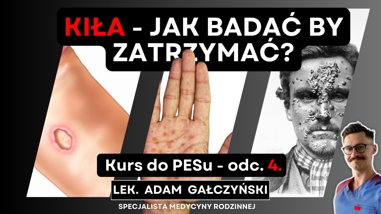Kiła - jak często powinnaś/powinieneś się badać?