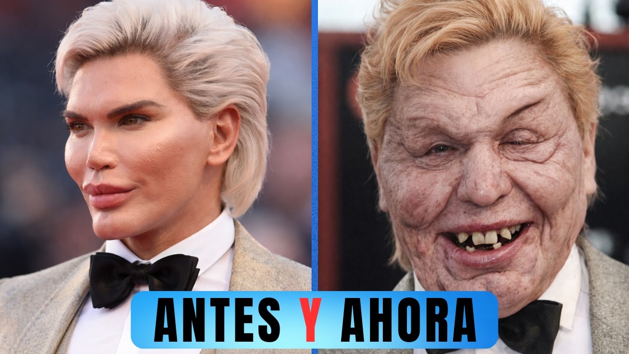 15 Celebridades Irreconocibles Tras Cirug&iacute;as Pl&aacute;sticas | Antes y Despu&eacute;s 2026