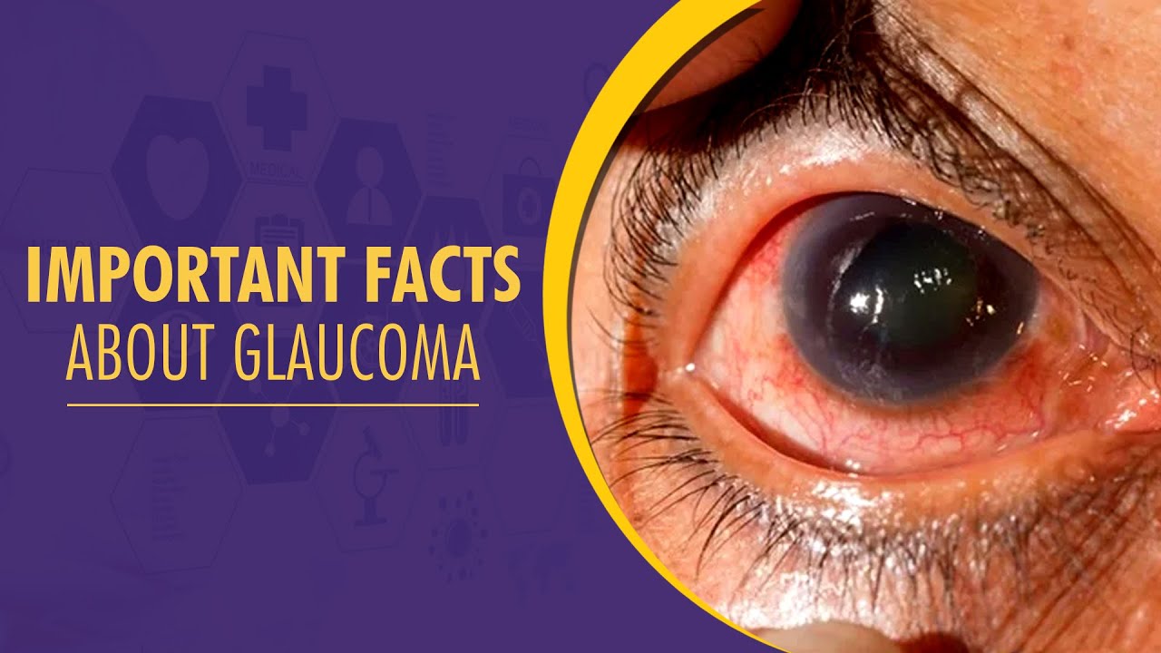 Important Facts About Glaucoma by Dr. Harsh Kumar | Centre For Sight