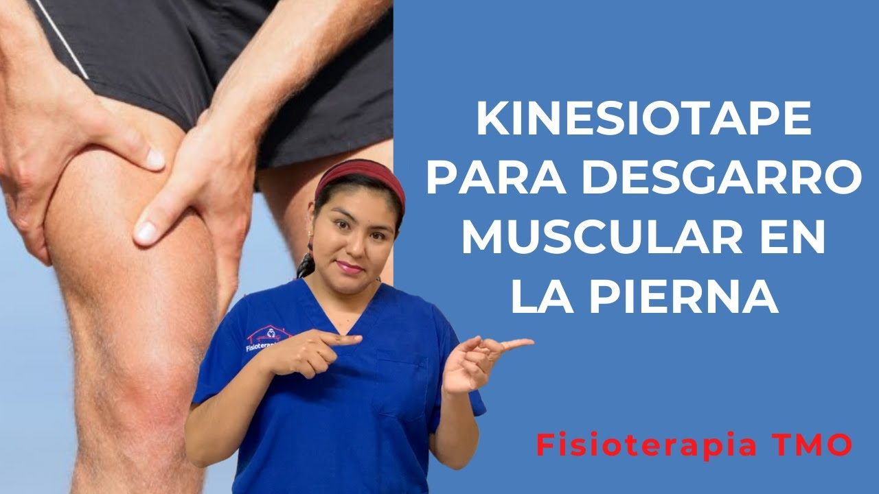 Tratamiento con kinesiotape para desgarro muscular en musculo cuadriceps por tiron