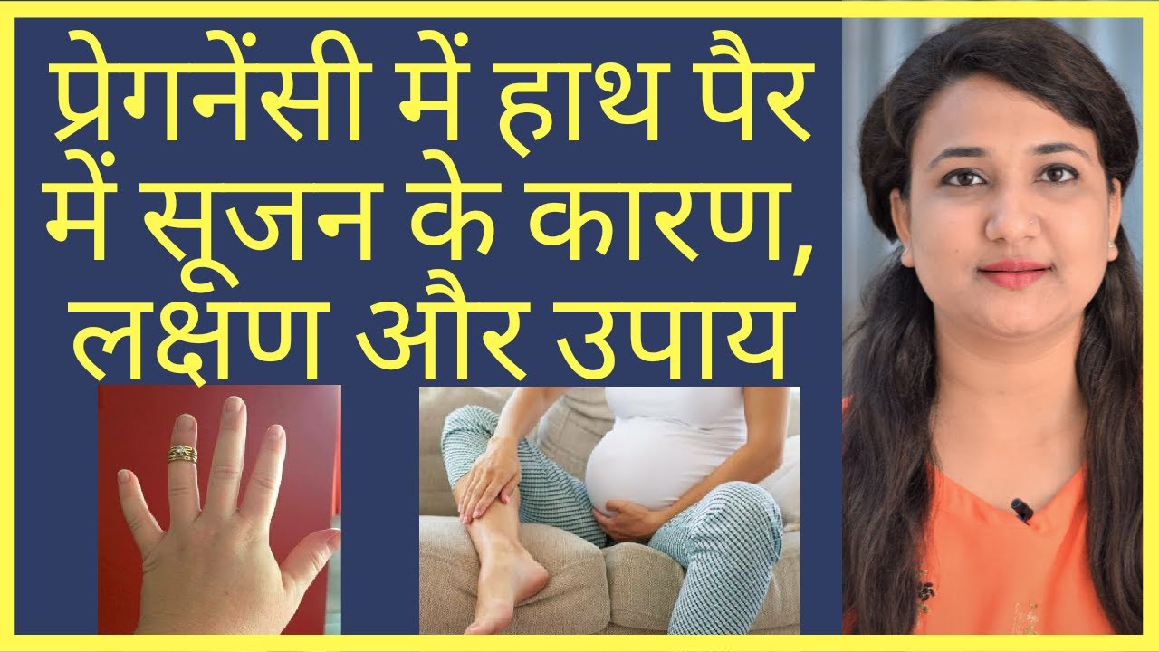 प्रेगनेंसी में हाथ पैर में सूजन कैसे ठीक करे ? OEDEMA IN PREGNANCY