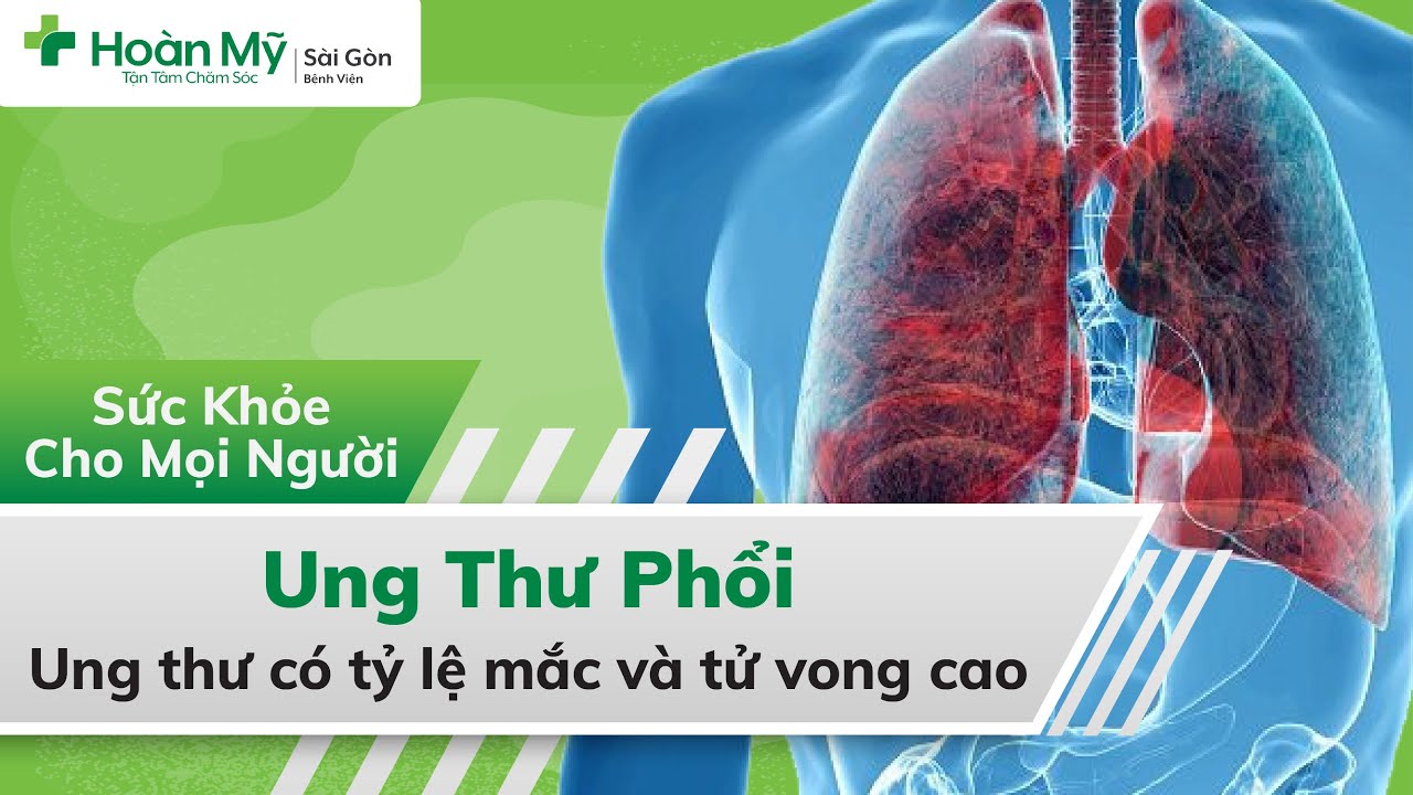 Ung thư phổi | Loại bệnh ung thư có tỷ lệ mắc và tử vong cao