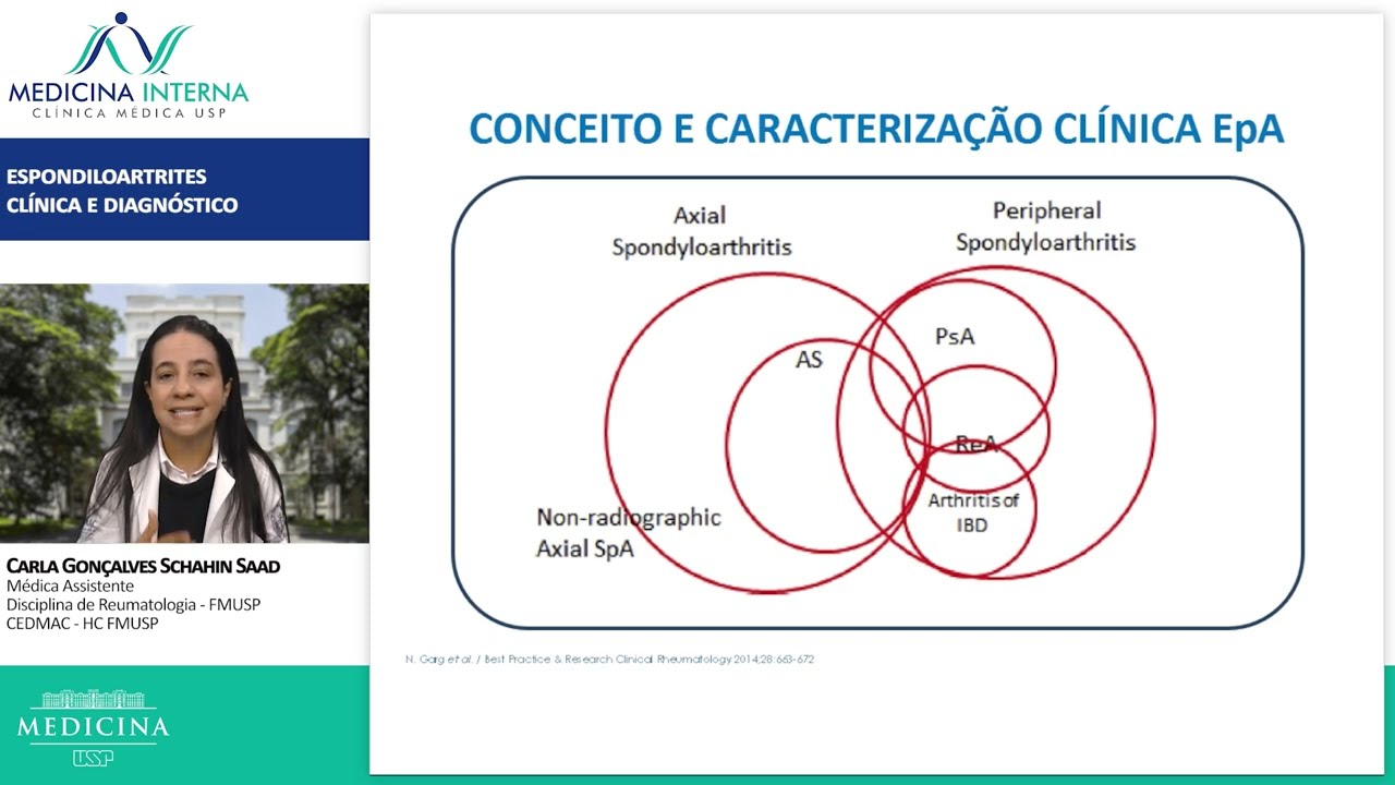 Espondiloartrites: Clínica e Diagnóstico