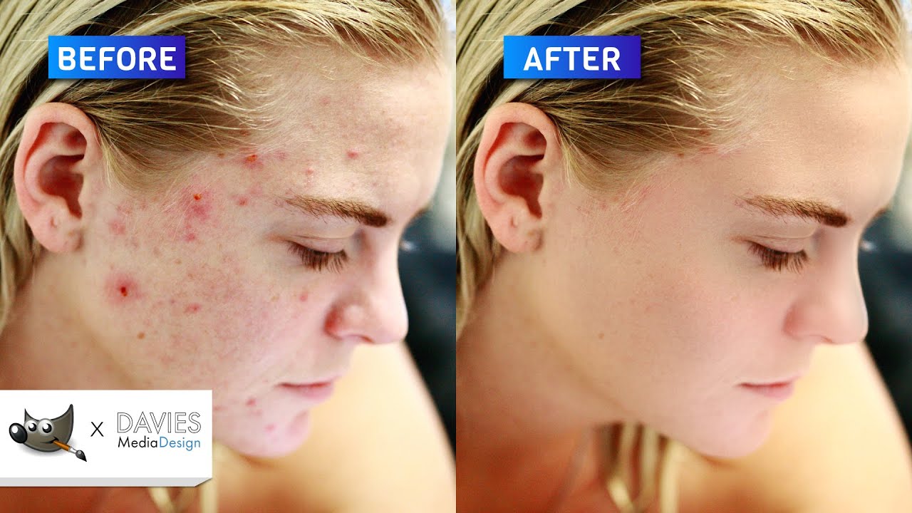 5 Step Next-Level Skin Retouching in GIMP