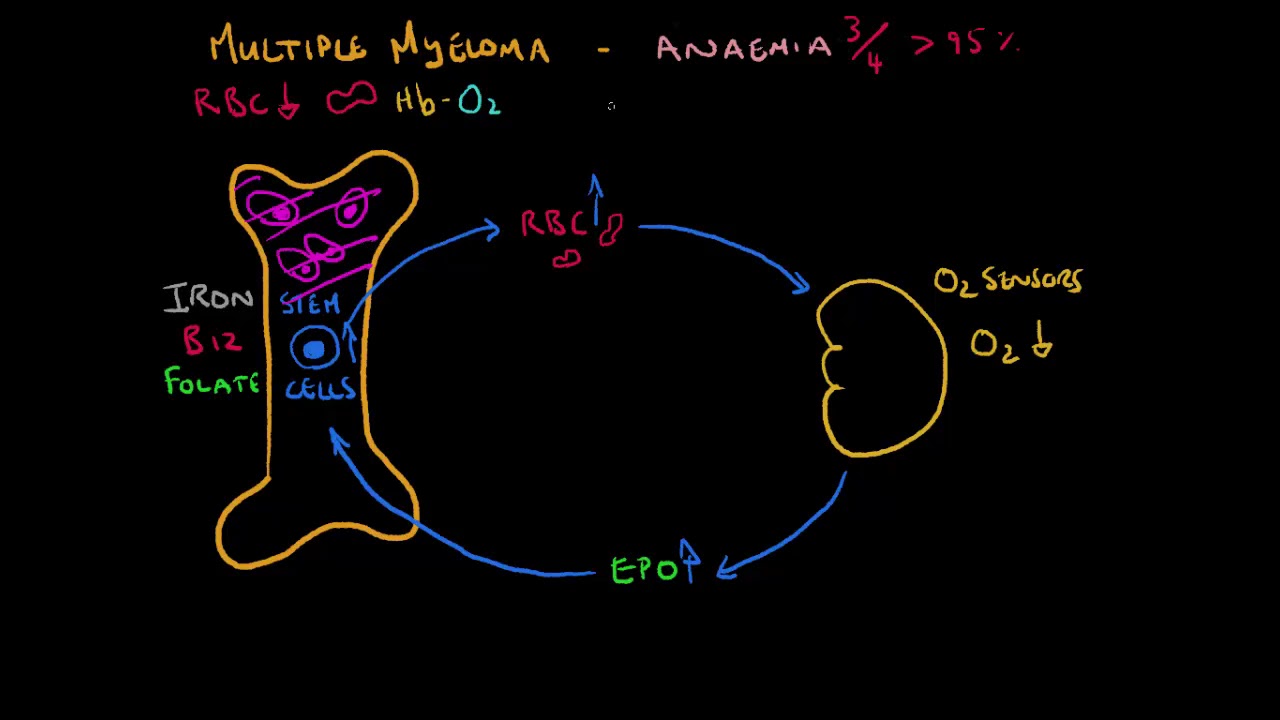 Multiple Myeloma Basics - Anaemia