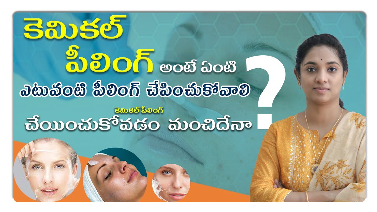 కెమికల్ పీలింగ్ అంటే ఏంటి ఎటువంటి పీలింగ్ చేపించుకోవాలి ? | Chemical peel |Dr. Kavya Chennamsetty