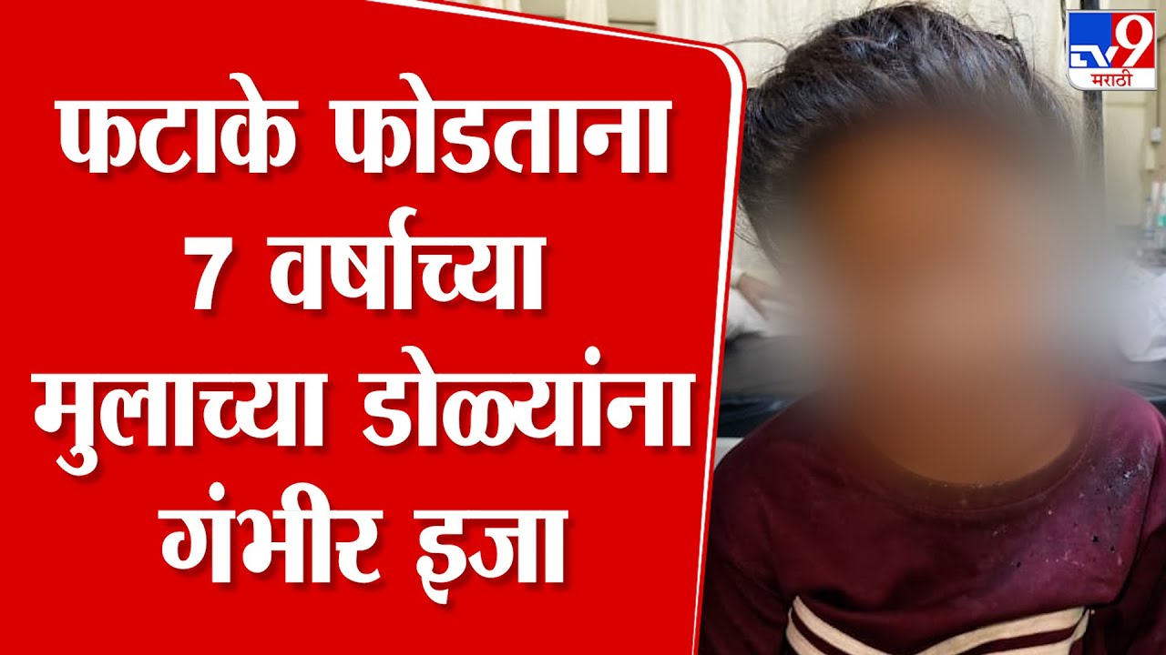Beed News |   फटाके फोडताना  7 वर्षाच्या मुलाच्या डोळ्यांना गंभीर इजा