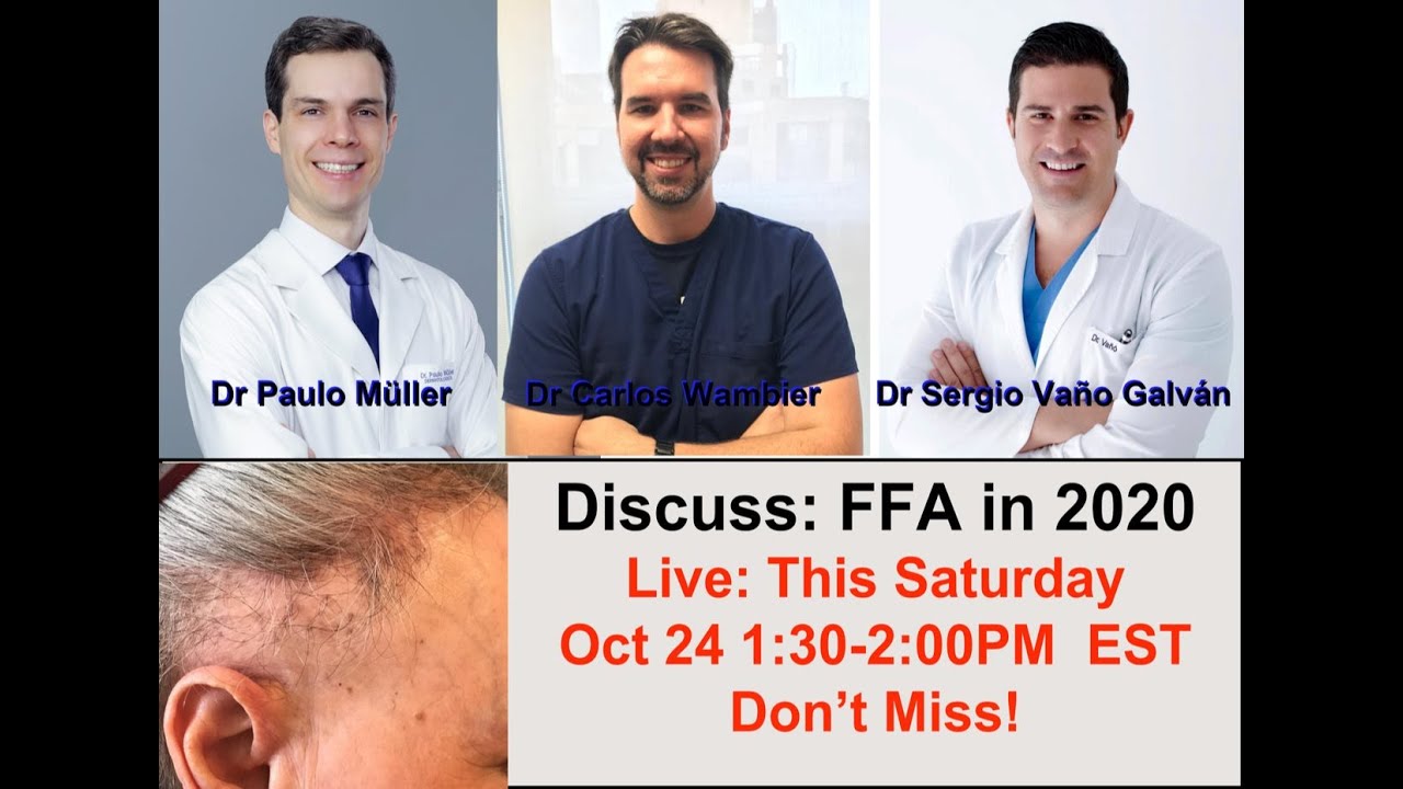 Everything about Frontal Fibrosing Alopecia (FFA in 2020)