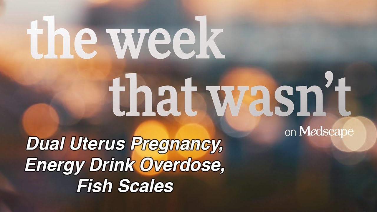 Dual Uterus Pregnancy, Energy Drink Overdose, Fish Scales | The Week That Wasn't