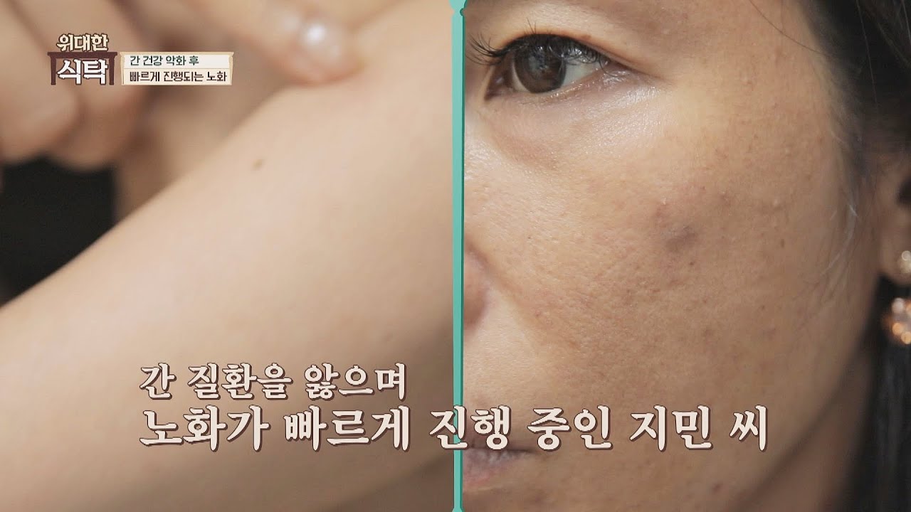 간 건강이 무너진 후.. 무려 7년이나 빠르게 진행된 노화 | 위대한 식탁 38회 | JTBC 220820 방송