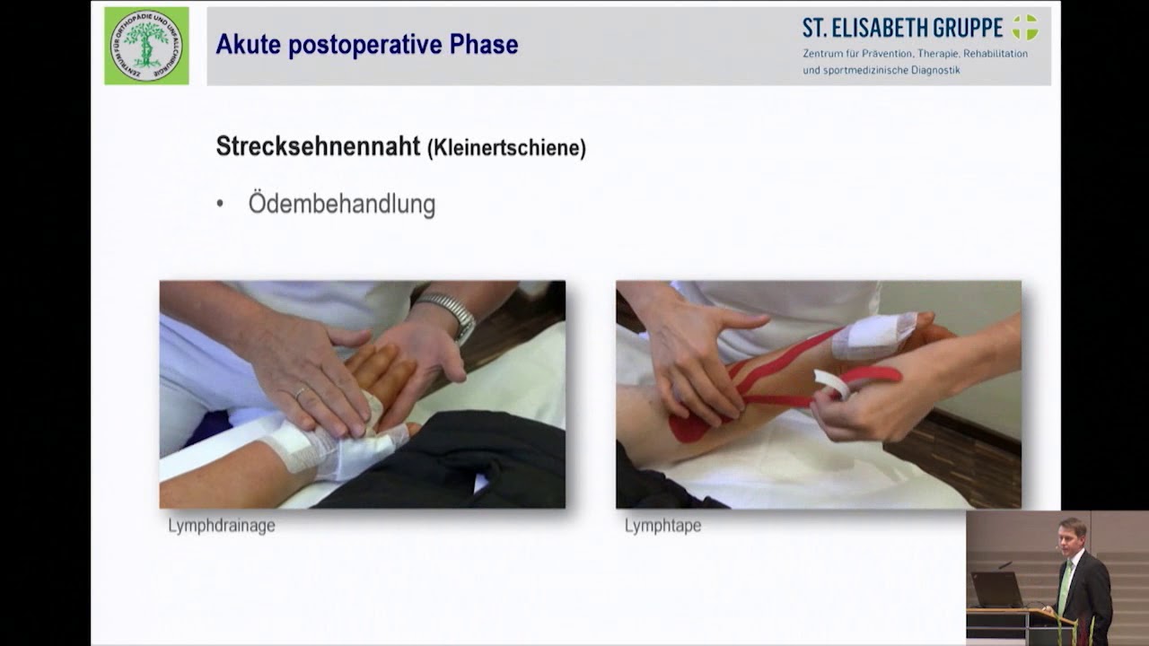 11/11 - Therapiemöglichkeiten bei Verletzungen an Hand und Handgelenk