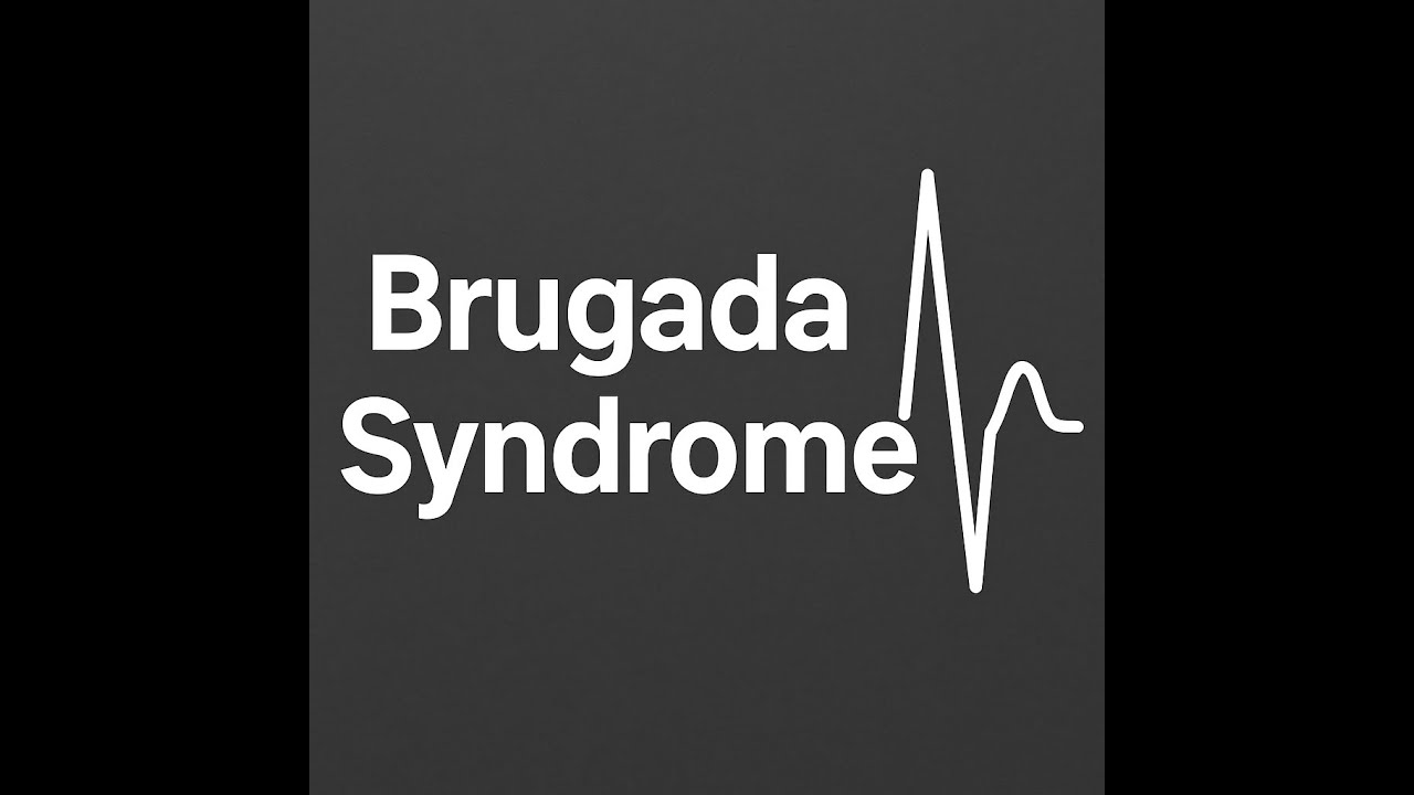 High Yield USMLE STEP 1 and STEP 2CK: Brugada Syndrome