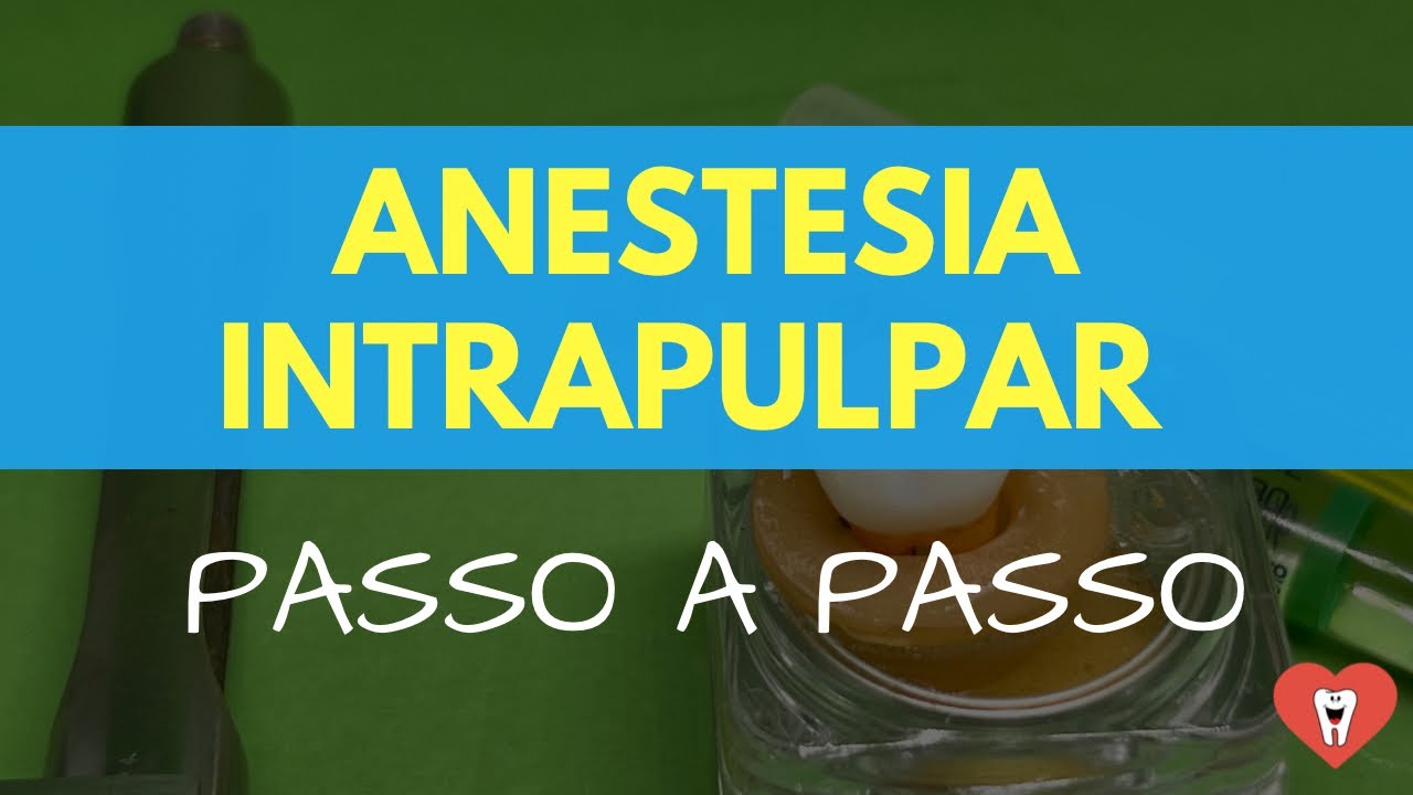ANESTESIA INTRAPULPAR (‘dentro do dente’)- PASSO A PASSO