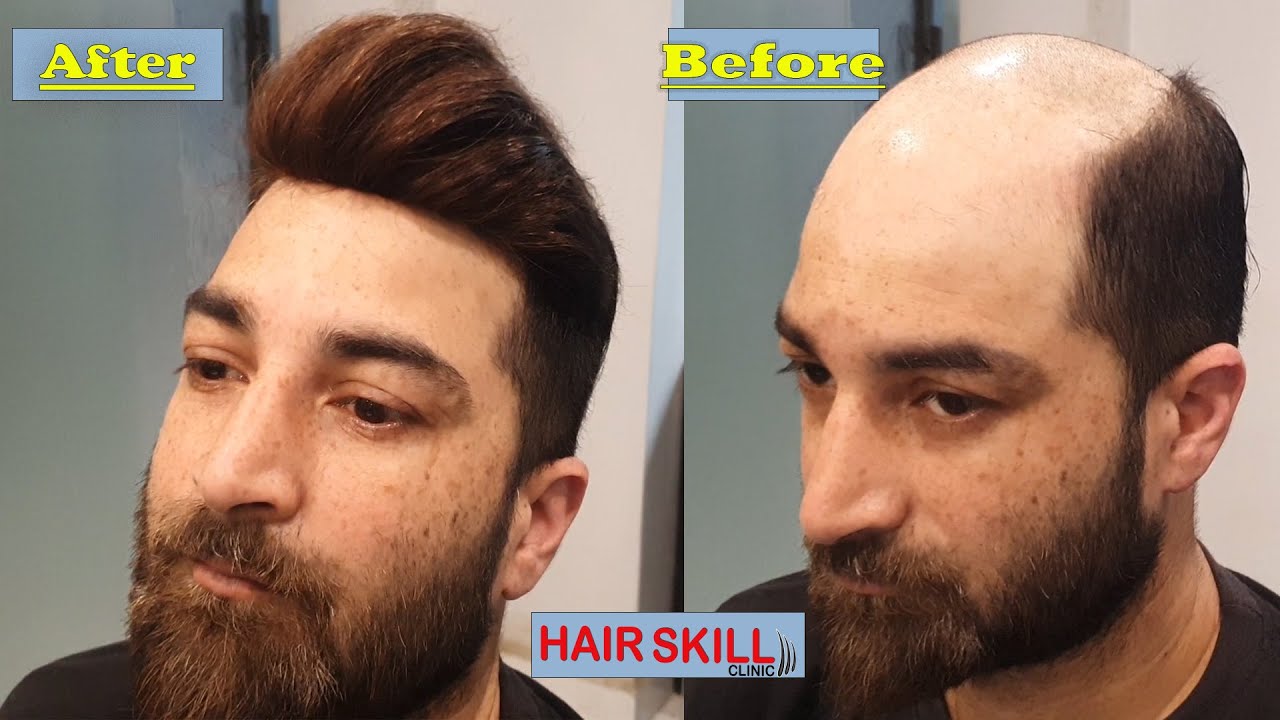hair wig by hair skill