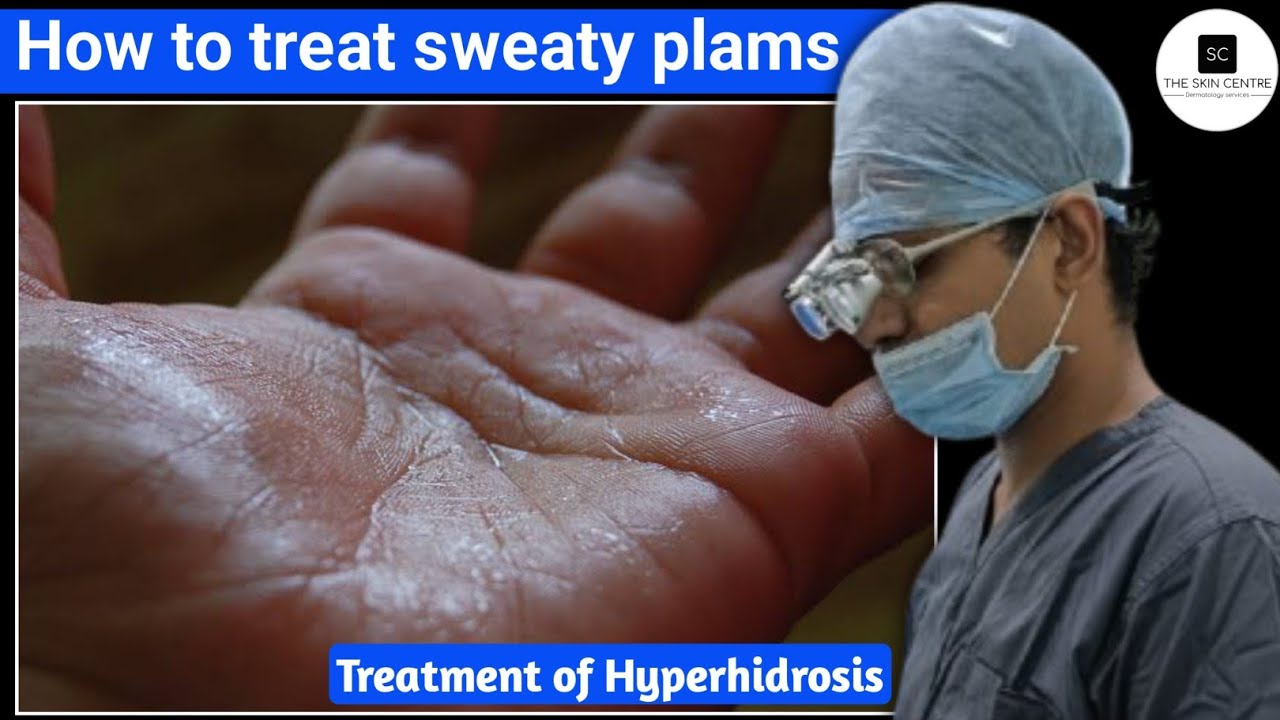 how to treat hyperhidrosis | how to treat sweaty plams| how to treat sweaty underarms #hyperhidrosis