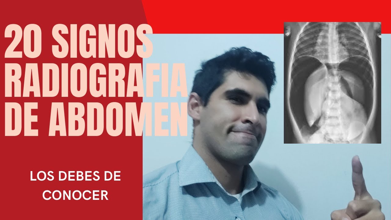 Radiografía de abdomen interpretación y patologías: 20 signos.