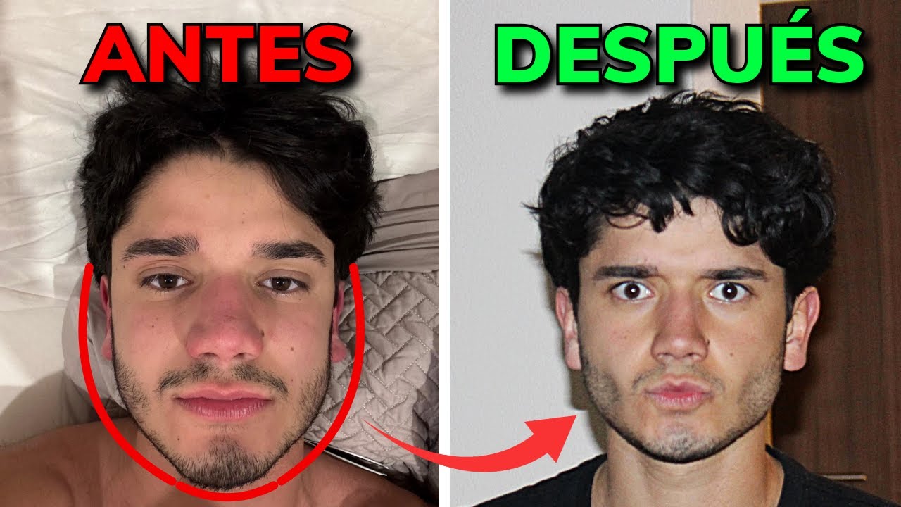 C&oacute;mo logr&eacute; que se me marcaran las mejillas huecas. (Gu&iacute;a Completa)