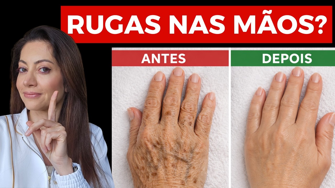 MÃOS ENVELHECIDAS? O guia definitivo para clarear manchas e tratar a flacidez em casa
