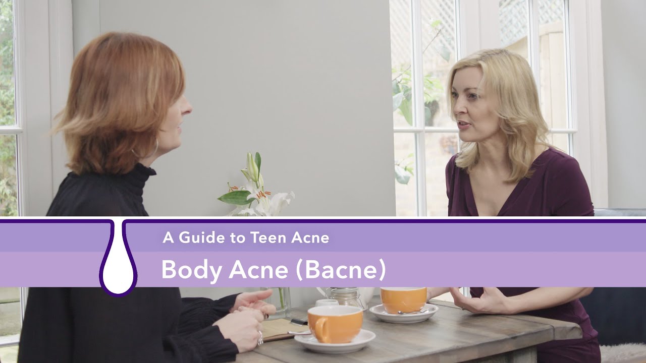 How to Treat Bacne / Body Acne - A Guide to Teen Acne