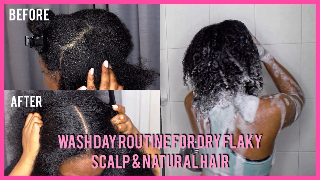 WASH DAY ROUTINE FOR EXTREME DRY FLAKY SCALP & NATURAL HAIR