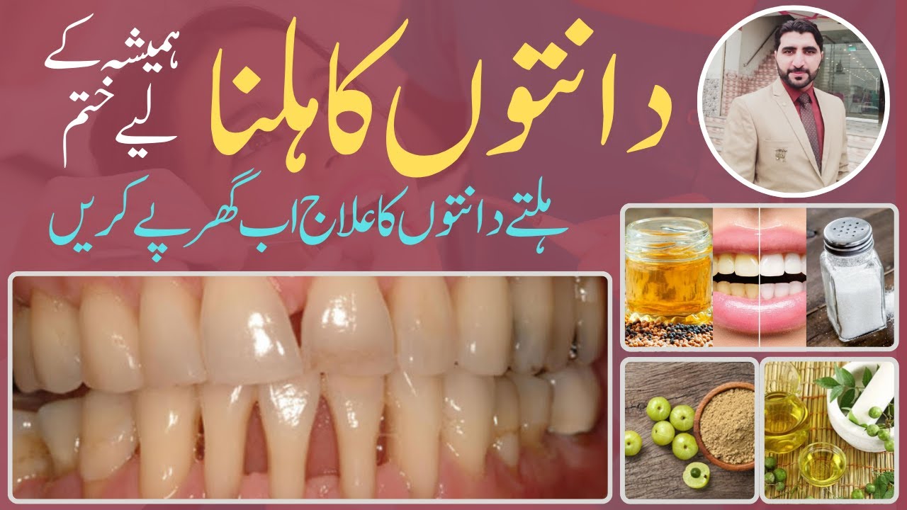 ہلتے ہوئے دانتوں کا علاج | Hilty hoye danton ka elaj | Treatment of loose teeth