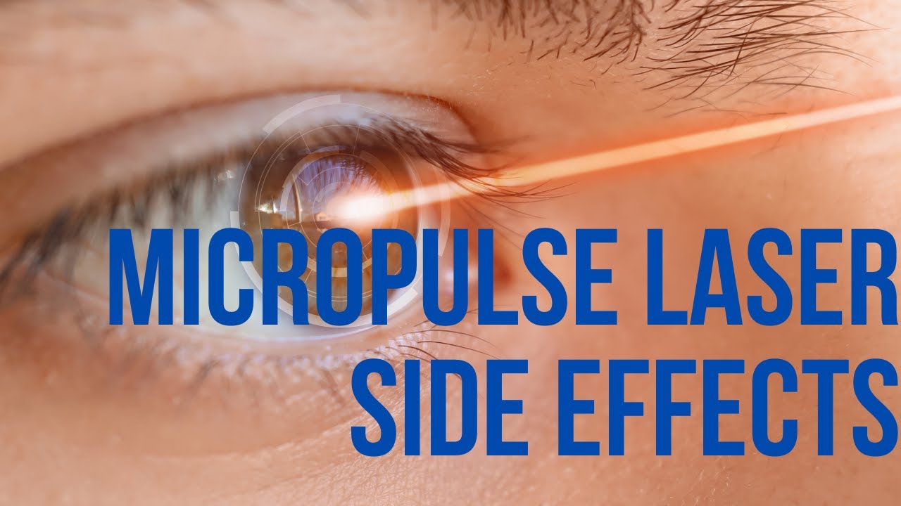 5 Potential Side Effects of Micropulse Laser Therapy for CSR