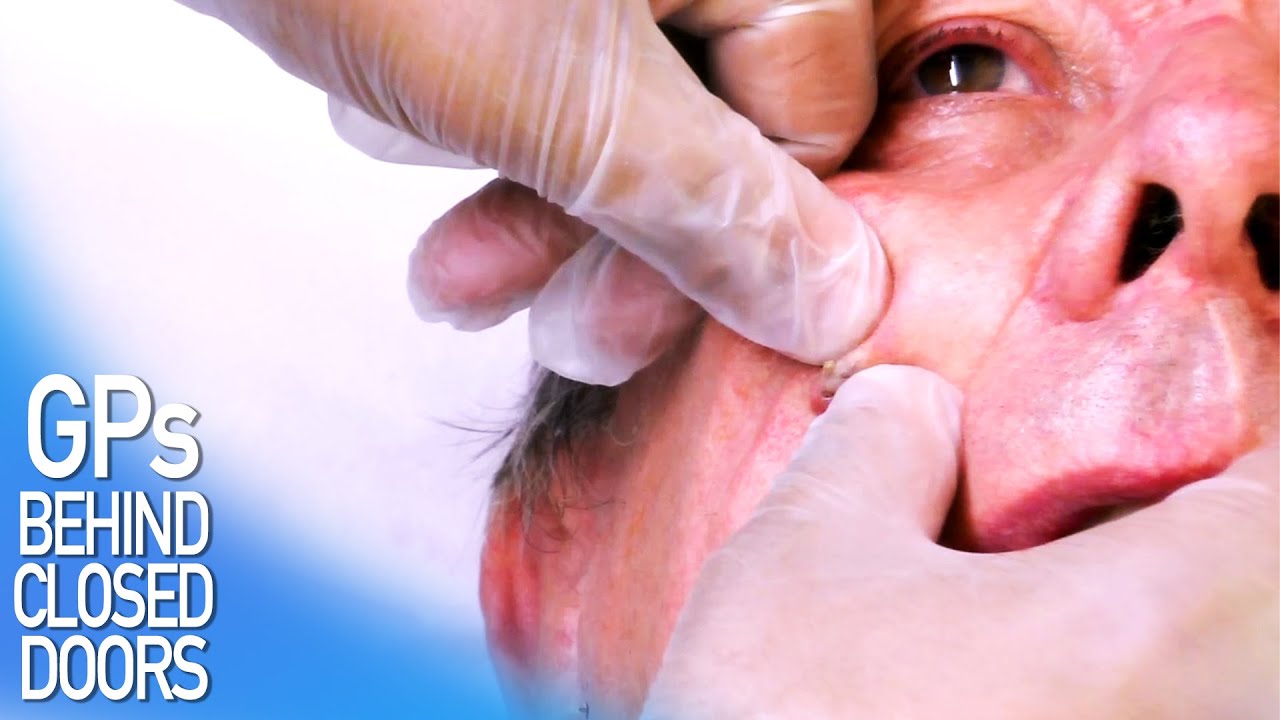 “Have You Tried Squeezing It?” | FULL EPISODE S04E04 | GPs: Behind Closed Doors