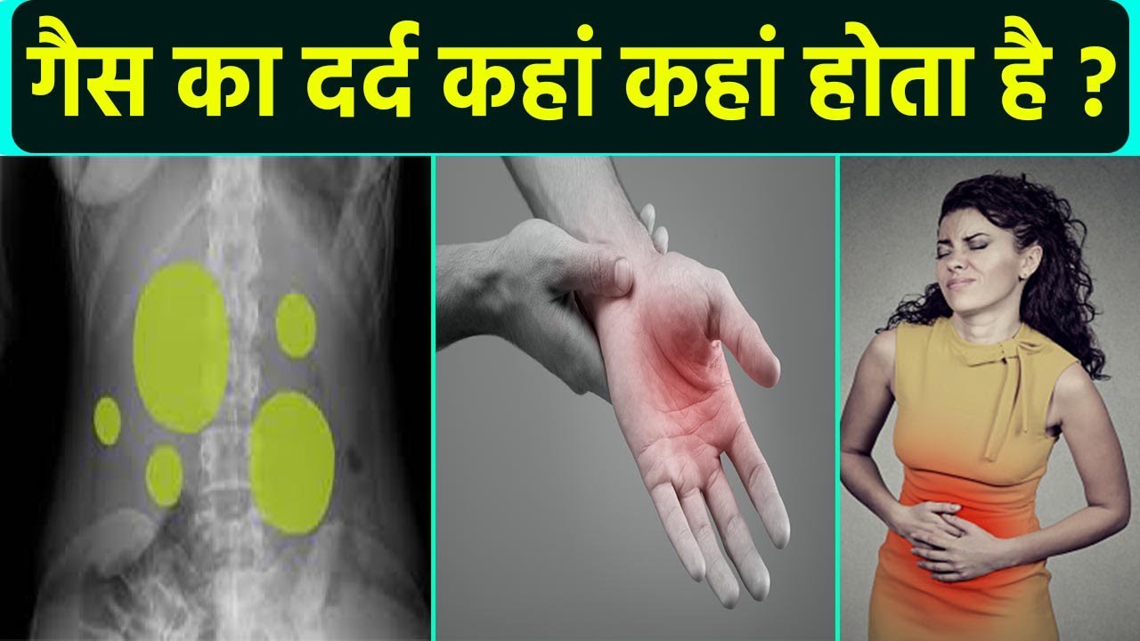 गैस का दर्द कहां कहां होता है | Gas Ka Dard Kahan Hota Hai | Boldsky