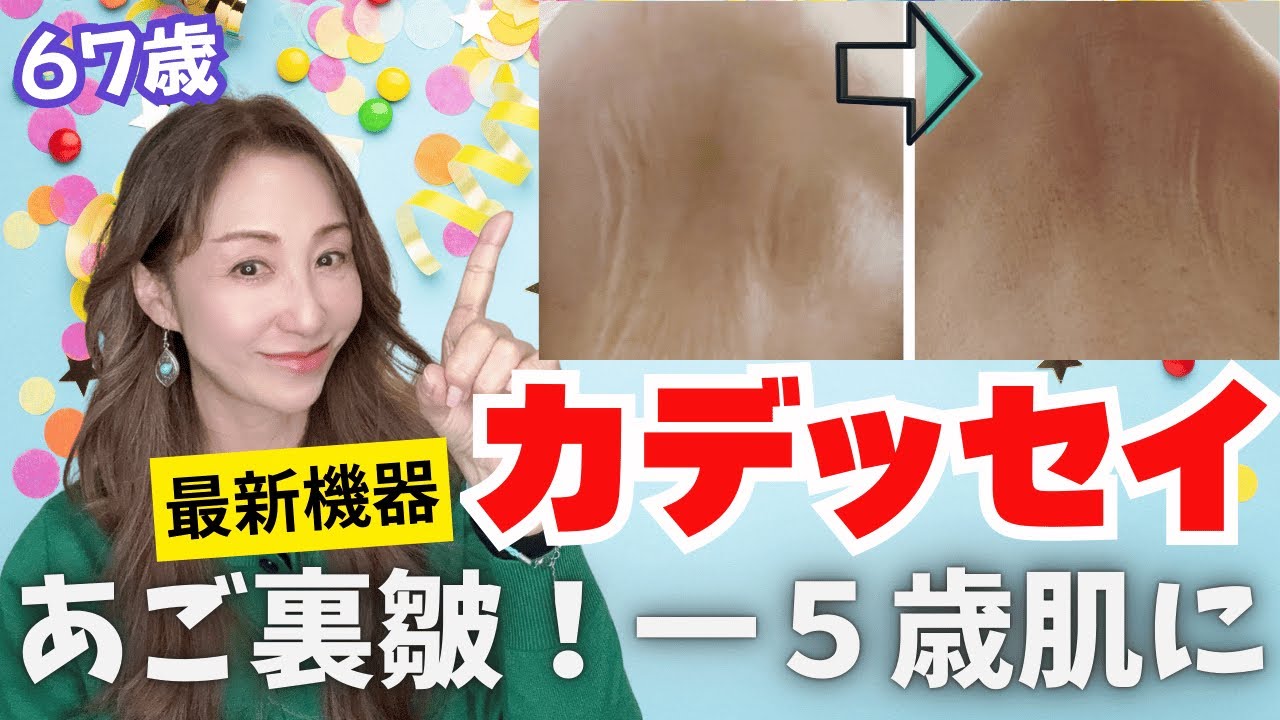 【美容医療レビュー】✨『カデッセイ』しわに最強⁉️最新機器の効果はどう？【高周波】【照射施術】