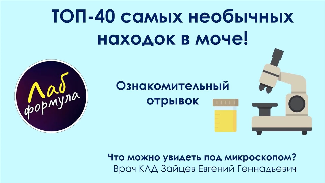 40 необычных находок при микроскопии мочи. Трейлер.