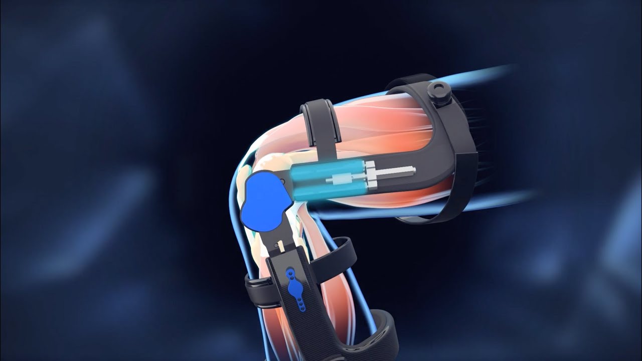 This Spring Loaded Knee Brace can help you