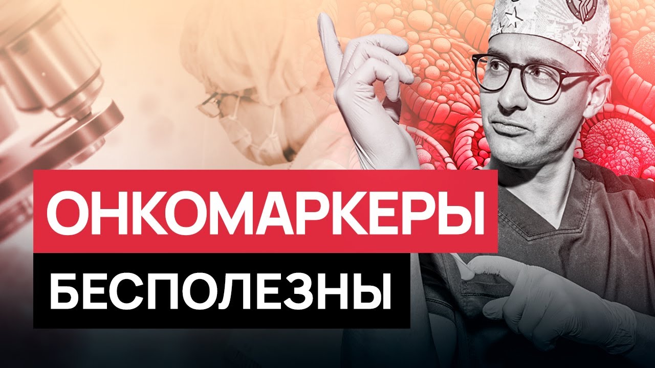 Самый бесполезный анализ на рак! Тест на онкомаркеры - дорого и неэффективно! #онкология #рак #рмж
