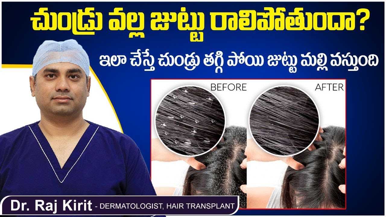 How To Get Rid Of Dandruff In Telugu | Dr Raj Kirit | Haircare Tips | Celestee Skin And Hair Clinic