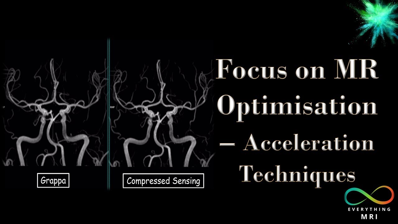 Focus on MR Optimisation - Acceleration Techniques