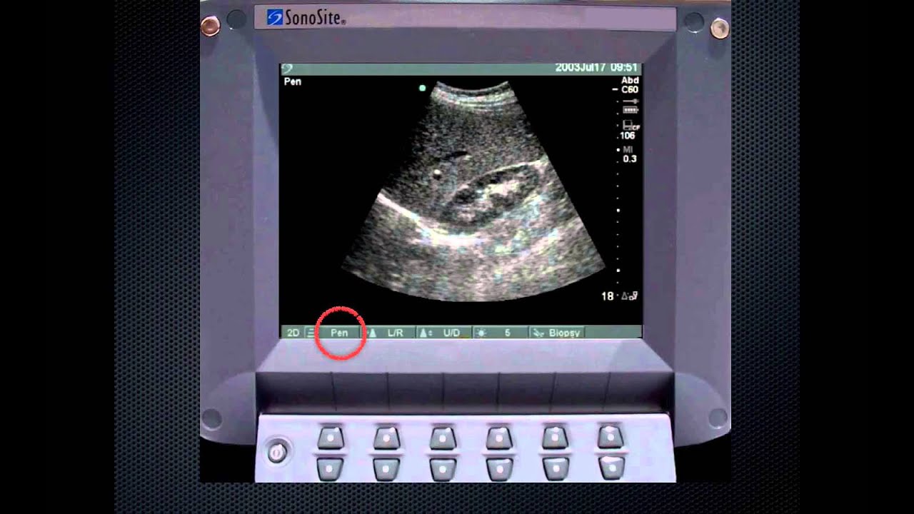 Bedside Ultrasound Physics, Knobology and Artifacts