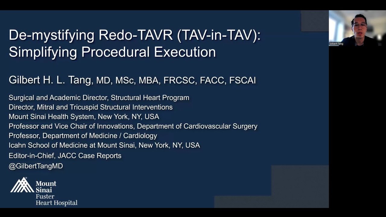 Lecture:  Redo-TAVR (TAV-in-TAV) Technique simplified