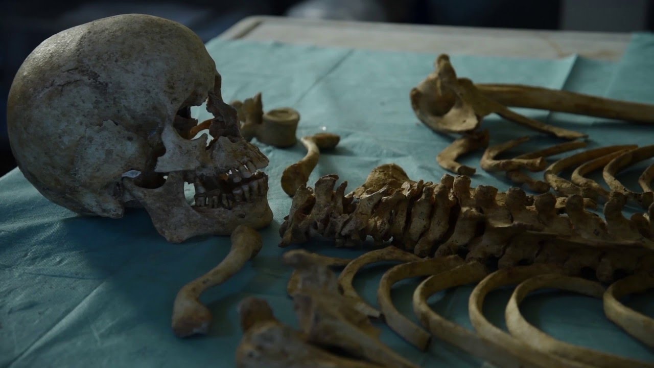 Paleopatologia, malattie dal passato