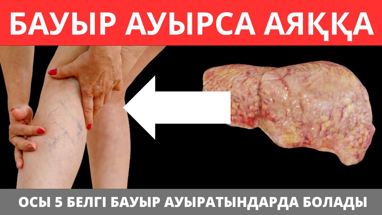 Бауырдың ӨЛІП ЖАТҚАНЫН көрсететін алғашқы 5 БЕЛГІ. БАУЫР АУРУЛАРЫНЫҢ ЕҢ АЛҒАШҚЫ БЕЛГІЛЕРІ