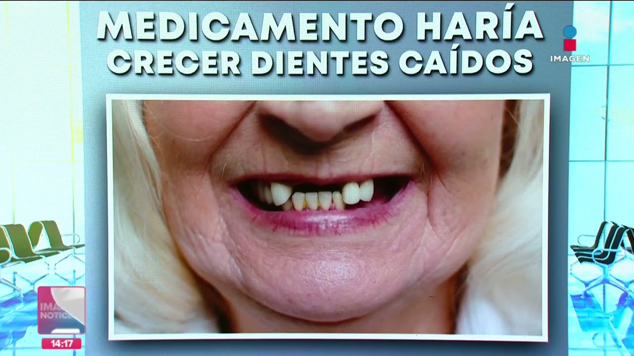 Desarrollan medicamento que hará crecer los dientes caídos | Noticias con Crystal Mendivil