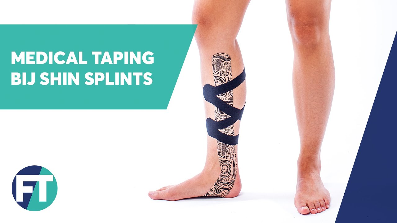 Shin Splint en mediaal tibiaal stresssyndroom tapen | Medical Taping | FysioTape