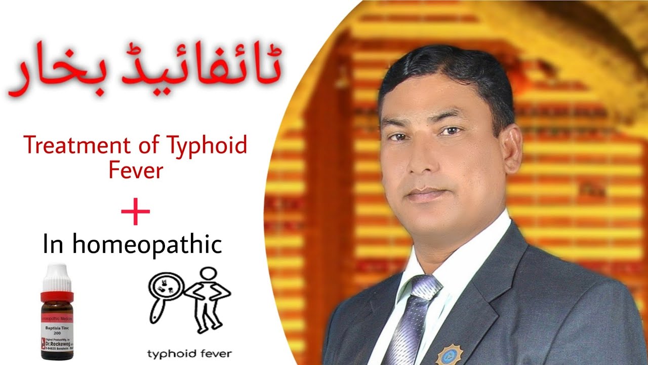 Treatment Of Typhoid Fever In Homeopathic Medicine ( Baptisia + ) Dr,Anwar