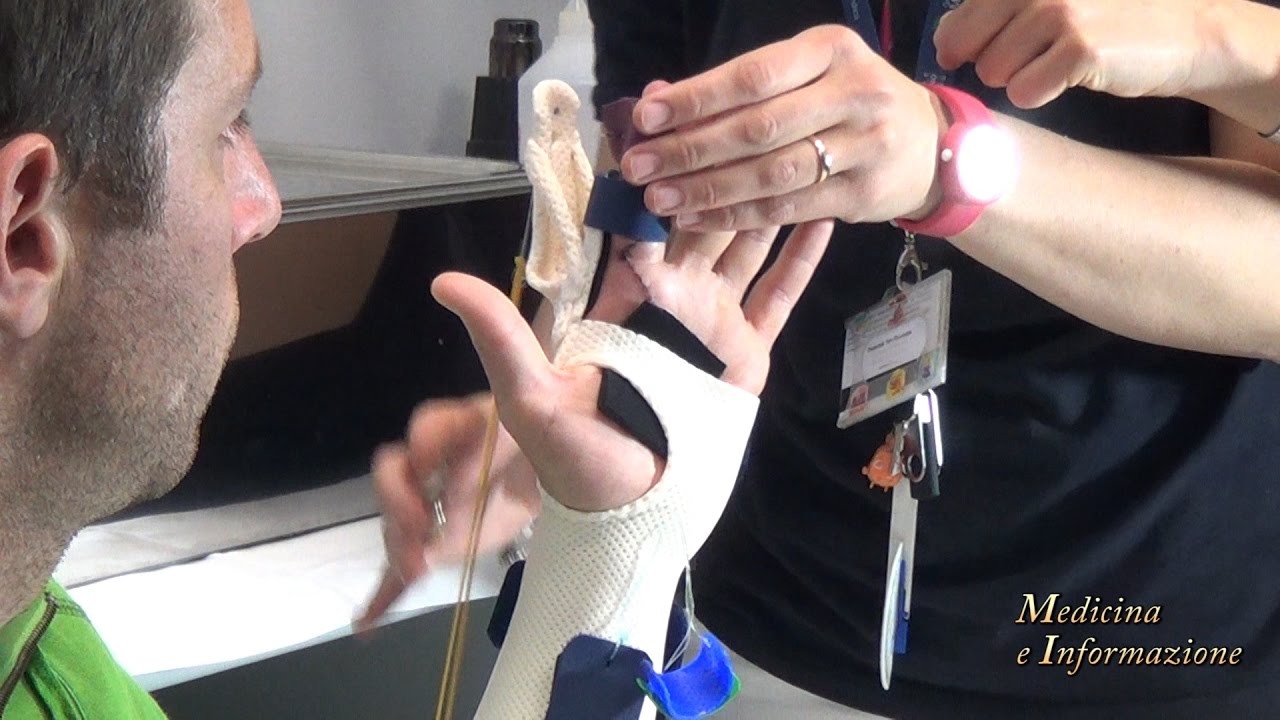 Riabilitazione della Mano: le nuove tecniche per artrosi, traumi, malformazioni
