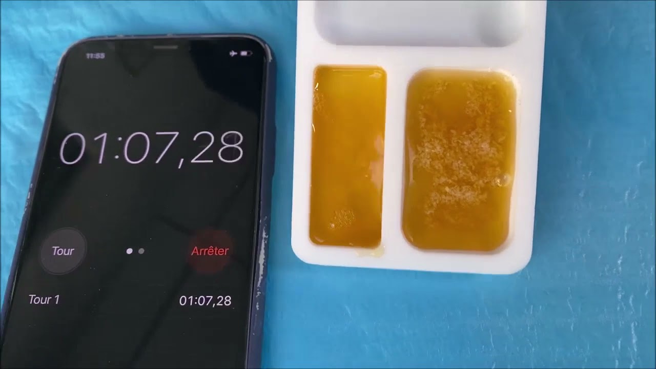 Sticky bone preparation with PRF - Platelet Rich Fibrin - in 2 mins for dental Bone Augmentation