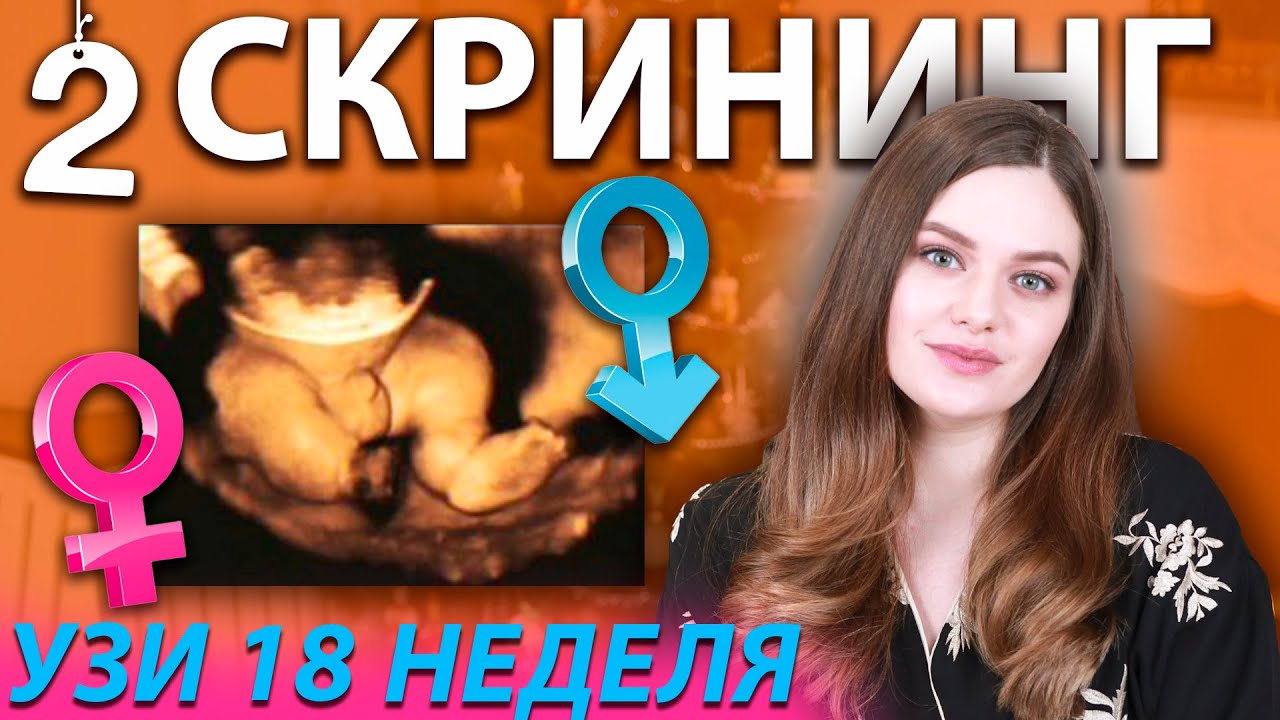 Узнали пол ребенка | УЗИ 18 неделя | Что видно на скрининге второго триместра? 18-21 неделя