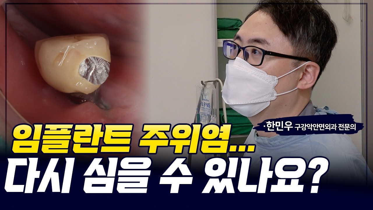 임플란트 주위염으로 제거했지만, 재식립 가능했습니다 #임플란트주의염 #임플란트재식립 #뼈이식